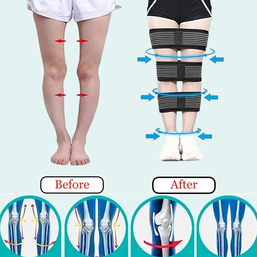 Leg Belt sarojmedicare